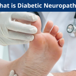 What is Diabetic Neuropathy?
